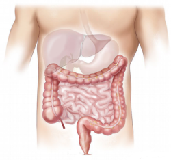 Leberfasten nach Prof. Dr. Worm, Praxis Dr. Schnutenhaus, Wuppertal,nicht-alkoholische Fettleber (NAFLD) 